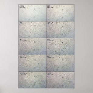 Confluence follow-up Chart