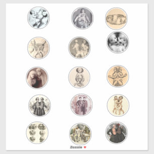 Conjoined Siamese Twins Sideshow Freaks Pics Art