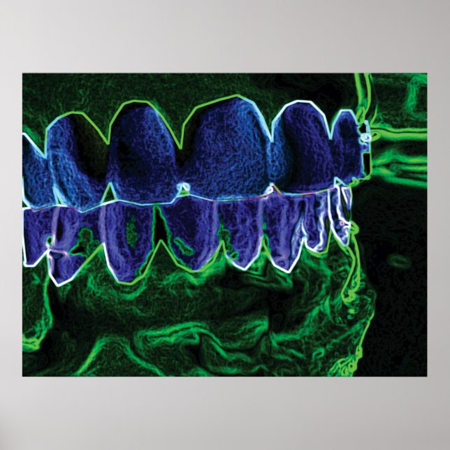 Cool Teeth Model Dentist Orthodontist Poster (Front)
