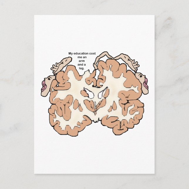 Cost an arm and a leg homunculus postcard (Front)