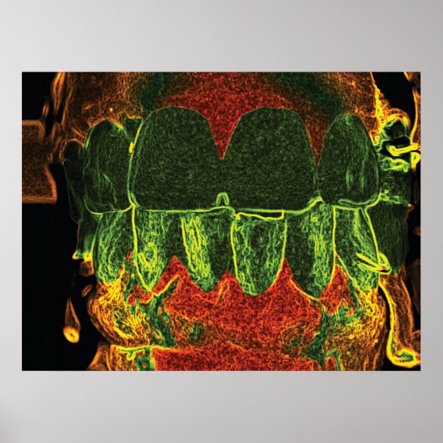 Crazy Teeth Bite Dentist Orthodontist Poster (Front)
