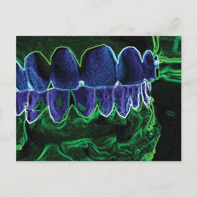 Crazy Teeth Model Dentist Orthodontist Card (Front)