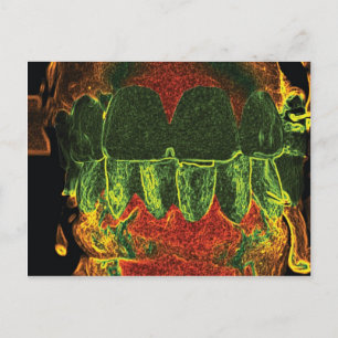 Crazy Teeth Model Design Dentist Orthodontist Card