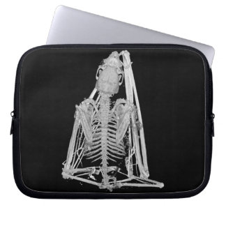Creepy Gothic Bat Skeleton Laptop Sleeve