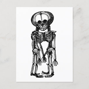 creepy siamese twins skeleton kids anatomy art postcard