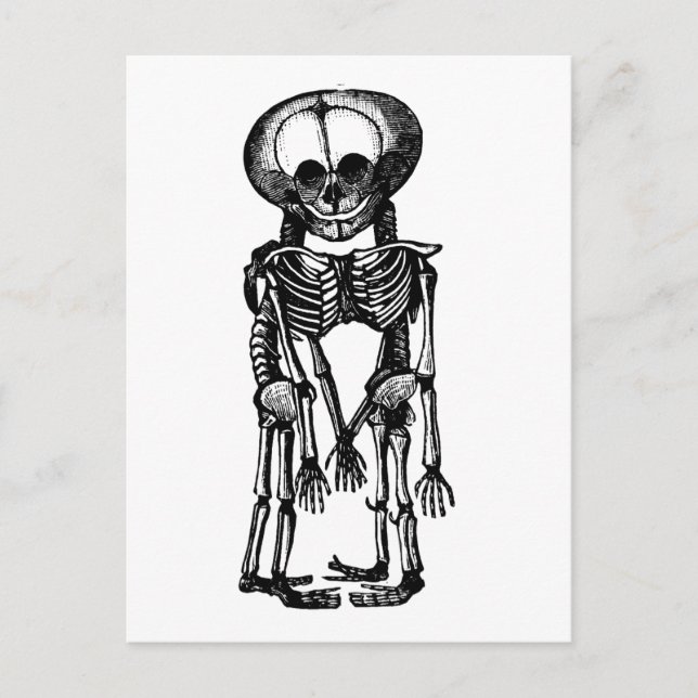creepy siamese twins skeleton kids anatomy art postcard (Front)
