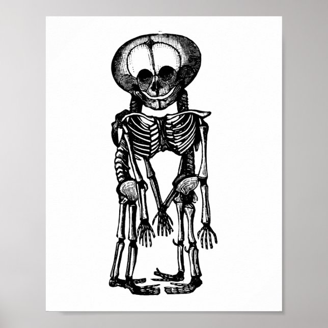 creepy siamese twins skeleton kids anatomy art poster (Front)