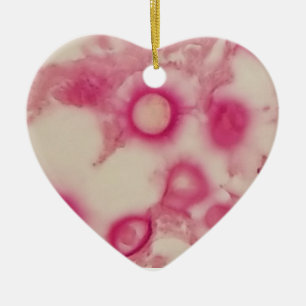 Cryptococcal Ornament