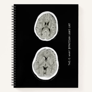 CT Scan_CTFOD_ This is what depression looks like  Notebook