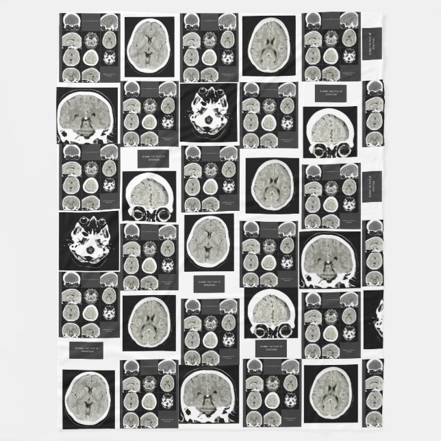 CT Scan_this is depression_CTFOD  Fleece Blanket (Front)
