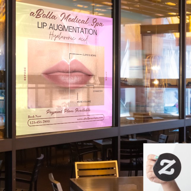Customise Med Spa Lip Augmentation Hyaluronic Fill (Restaurant Window)