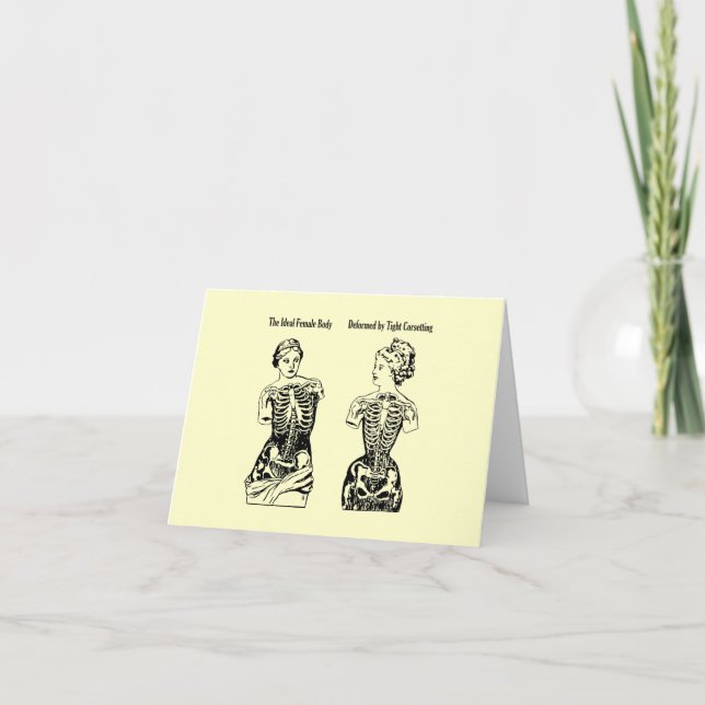 Deformed by Corsetting ~ Cards (Front)