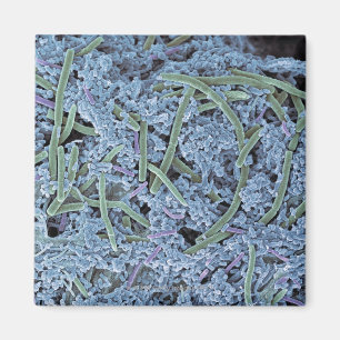 Dental plaque, coloured scanning electron magnet