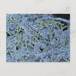 Dental plaque, coloured scanning electron postcard