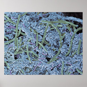 Dental plaque, coloured scanning electron poster