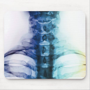Digital Cervical X-Ray Art Mouse Pad