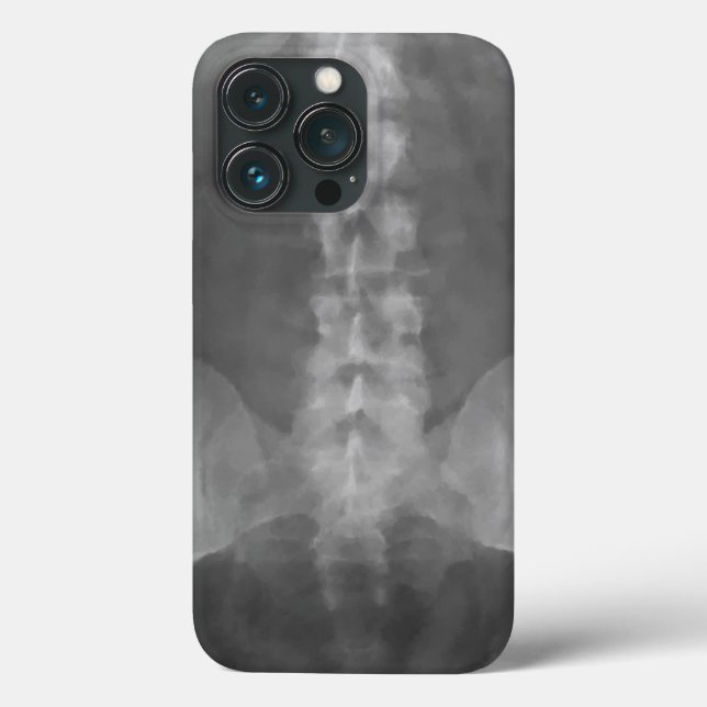 Digital X-Ray Art Case-Mate iPhone Case (Back)