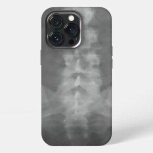 Digital X-Ray Art iPhone 13 Pro Case