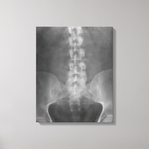 Digital X-Ray Art Wrapped Canvas