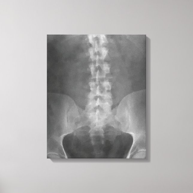 Digital X-Ray Art Wrapped Canvas (Front)