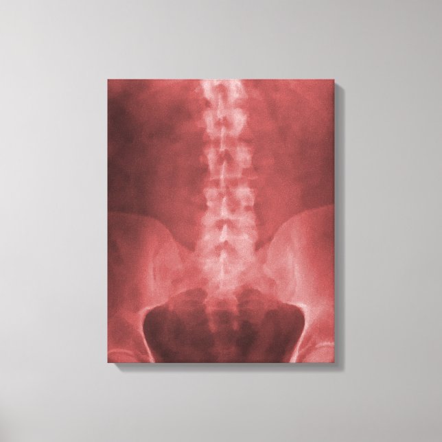 Digital X-Ray Art Wrapped Canvas (Front)