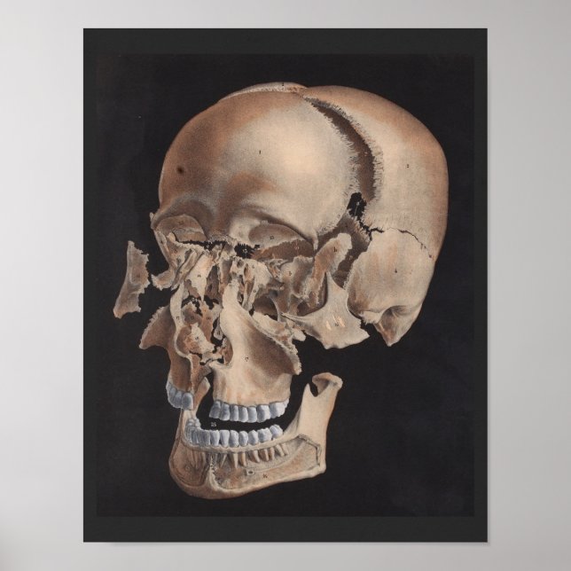 Disarticulated Exploded Skull Print (Front)