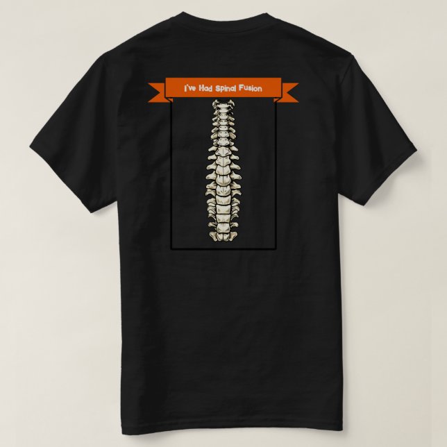 "Don't Judge Me I've Had Spinal Fusion" T-Shirt (Design Back)