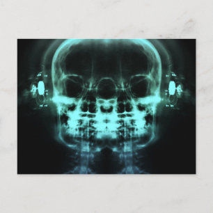 Double X-Ray Skulls with Headphones - Teal Postcard