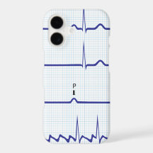 ECG/EKG iPhone case