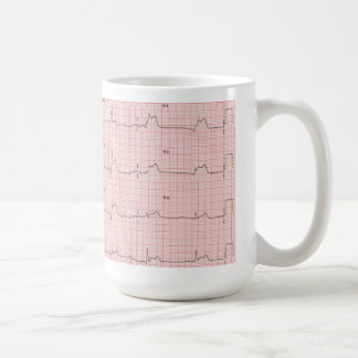 ECG mug