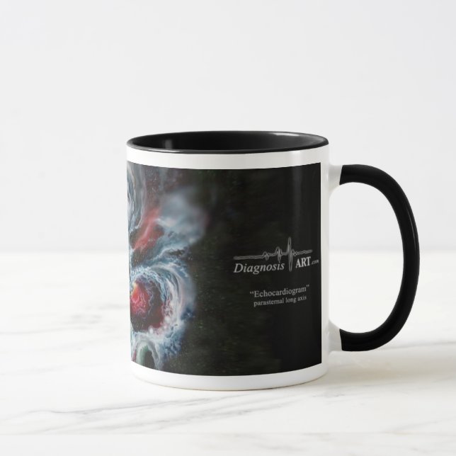 "Echocardiogram" coffee mug! Mug (Right)