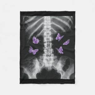 Egirl Xray Skeleton Pink Butterfly Harajuku Y2k Da Fleece Blanket