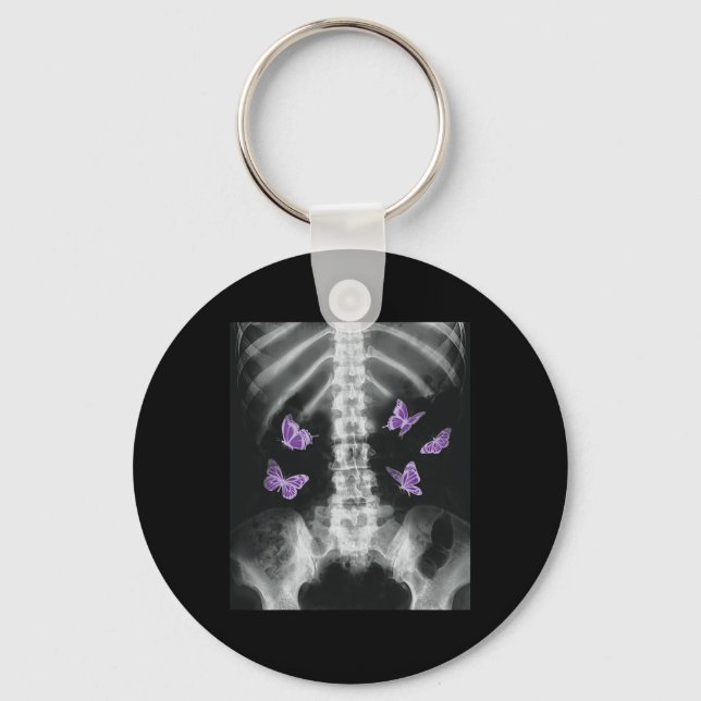 Egirl Xray Skeleton Pink Butterfly Harajuku y2k Da Key Ring (Front)