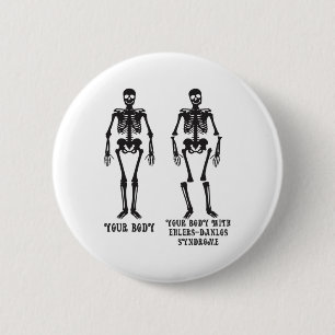 Ehlers - Your Body With Ehlers Danlos Syndrome Awa 6 Cm Round Badge
