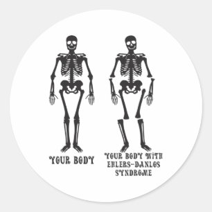 Ehlers - Your Body With Ehlers Danlos Syndrome Awa Classic Round Sticker