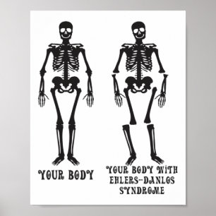 Ehlers - Your Body With Ehlers Danlos Syndrome Awa Poster