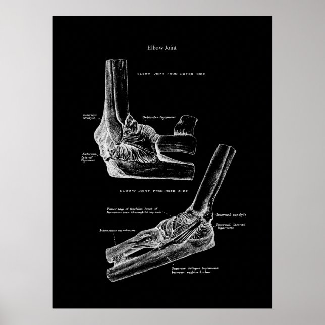 Elbow Joint Anatomy Orthopaedic Wall Decor (Front)