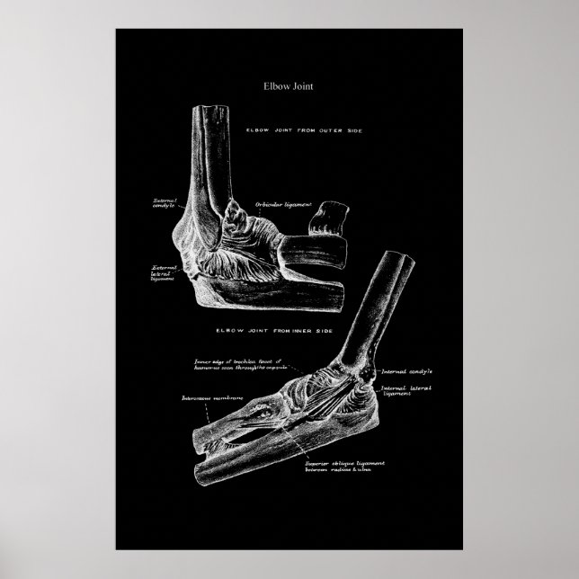 Elbow Joint Orthopaedic Wall Decor (Front)