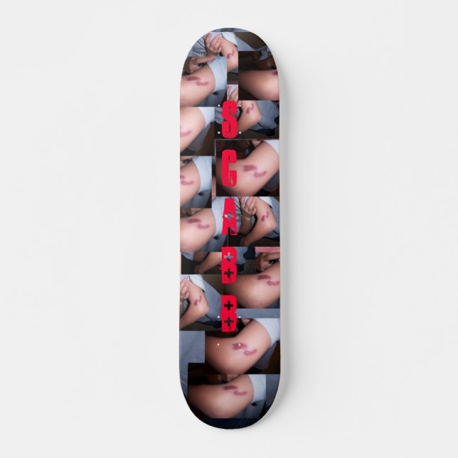 Elbow SCABB Skateboard (Front)