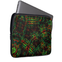Elliptical destroyed, up lines flashy green to red