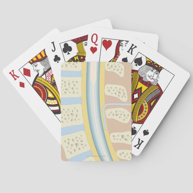 Epidural Anaesthesia Playing Cards (Back)