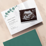 Eucalyptus Pregnancy Baby Scan Announcement<br><div class="desc">It's always a good time to share this exciting news with your nearest and dearest. Customise this card by uploading your ultrasound photo,  add your details so your nearest and dearest know of this special news.</div>