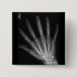 Extra Digit X-ray Right Hand 15 Cm Square Badge