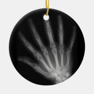 Extra Digit X-ray Right Hand Ceramic Tree Decoration