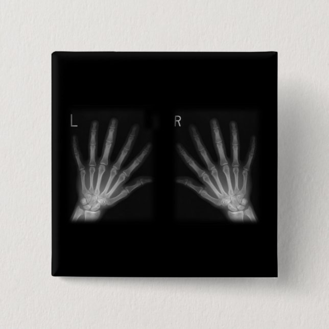 Extra Digit X-ray Right & Left Hands 15 Cm Square Badge (Front)