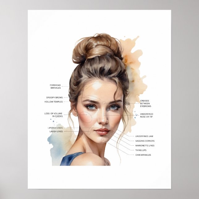 Face Map For Dermal Filler And Botox Poster (Front)
