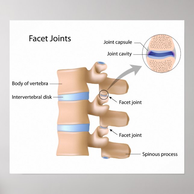 Facet joint Poster (Front)