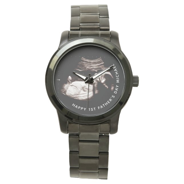 Father's Day Custom Name Photo Baby Sonogram  Watc Watch (Front)