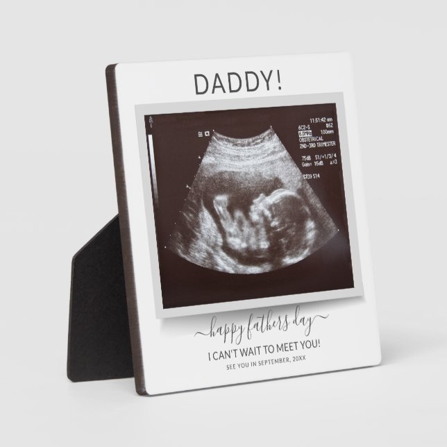 Fathers Day Ultrasound Photo Pregnancy Reveal Dad Plaque (Front)