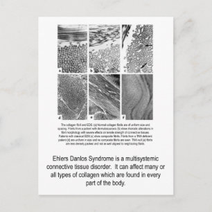 Faulty Collagen EDS Awareness Postcard